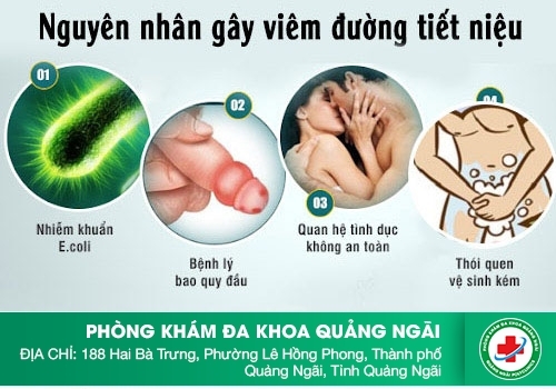 Nguyên nhân và cách điều trị đau buốt khi xuất tinh là gì?