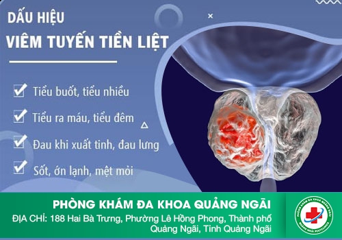 Viêm tuyến tiền liệt